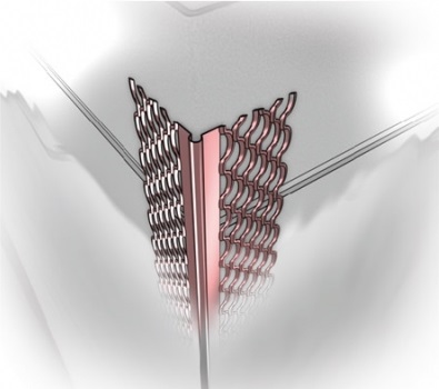 GESSLER NAR. DO TYNK MOKR. 34ALU 2,5MB [25] paczki